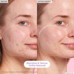 Suero-Blackberry-Retinol-Blemish-Serum