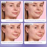 Suero-Blackberry-Retinol-Blemish-Serum